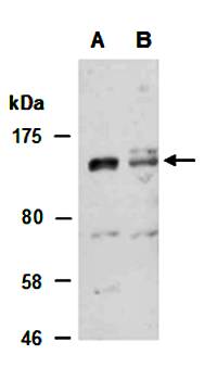 KDM3A (C) Antibody, Rabbit Polyclonal