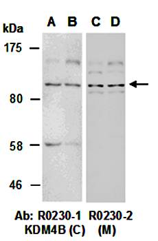 KDM4B (C) Antibody, Rabbit Polyclonal