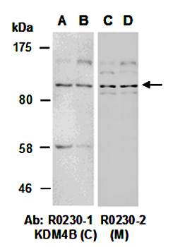 KDM4B (M) Antibody, Rabbit Polyclonal
