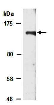 KDM4B (M) Antibody, Rabbit Polyclonal