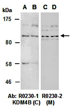 KDM4B (vPairTM) Antibodies