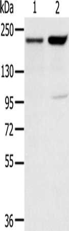 KDM5A Antibody