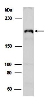 KDM5A (C) Antibody, Rabbit Polyclonal
