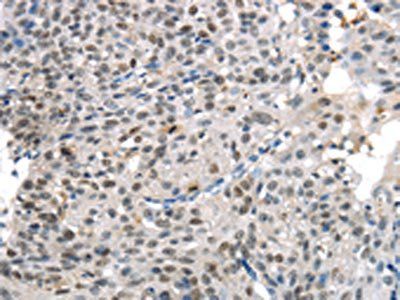 KDM5C Antibody
