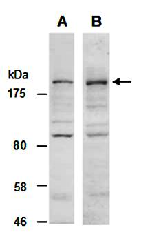 KDM5C (N) Antibody, Rabbit Polyclonal
