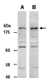 KDM5C (C) Antibody, Rabbit Polyclonal