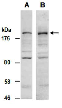 KDM5C (vPairTM) Antibodies