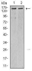 KDM6A Antibody