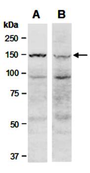 KDM6A (N1) Antibody, Rabbit Polyclonal