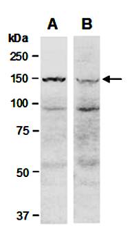 KDM6A (N2) Antibody, Rabbit Polyclonal