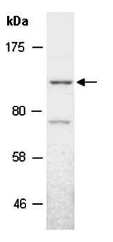 KDM7 (C) Antibody, Rabbit Polyclonal