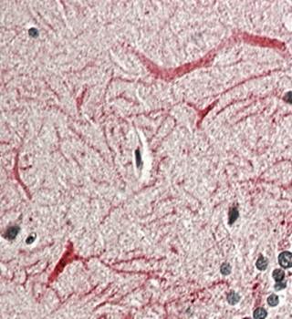 KEAP1 (aa41-53) Antibody