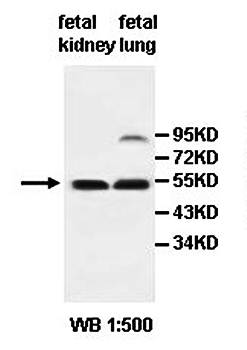 Keratin 7 Rabbit Polyclonal Antibody