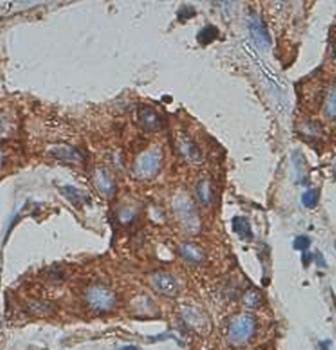 Keratin 7 Rabbit Polyclonal Antibody