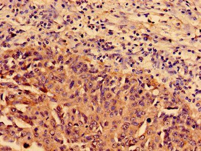 KRT4 Antibody