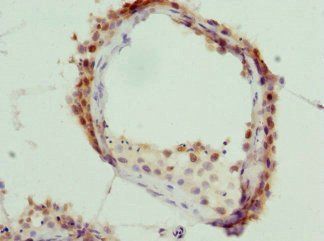 KHDRBS3 Antibody