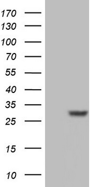 Ki67 Antibody
