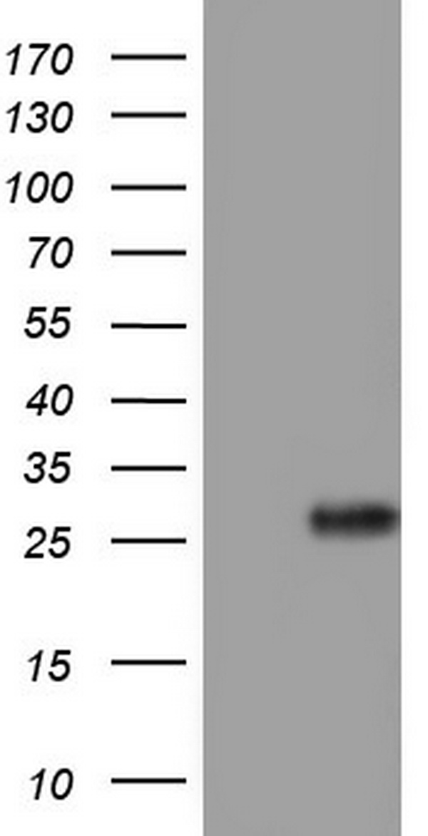 Ki67 Antibody