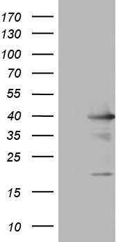 Ki67 Antibody