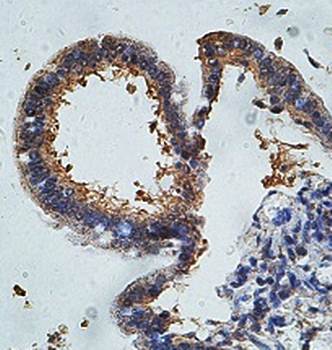 KIAA0562 Rabbit Polyclonal Antibody