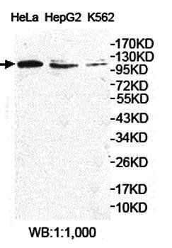 KIAA0562 Rabbit Polyclonal Antibody