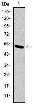KID Antibody