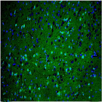 KIF1B Rabbit Polyclonal Antibody (FITC)