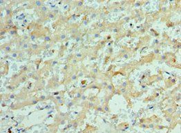 KIF2C Antibody