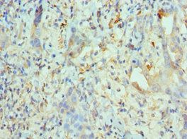 KIF2C Antibody