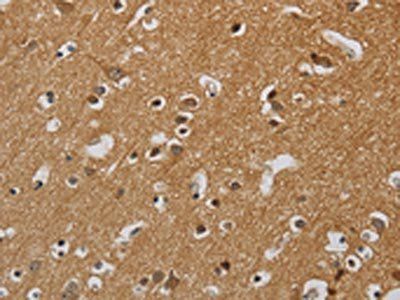 KIF4A Antibody