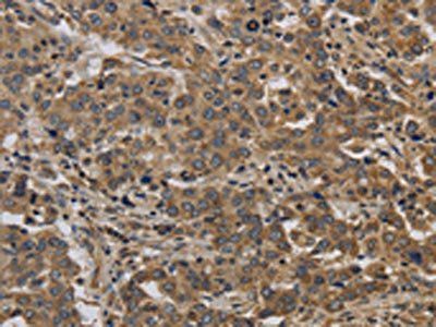 KIF4A Antibody