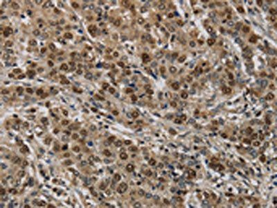 KIF4A Antibody