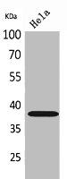 KIR2DL3/KIR2DS2 Antibody