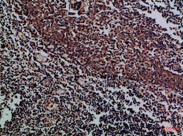 KIR2DL5A/KIR2DL5B Antibody
