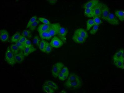 KIR3DS1 Antibody