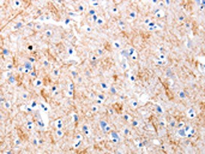 KISS1 Antibody