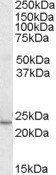 KLF16/DRRF Antibody