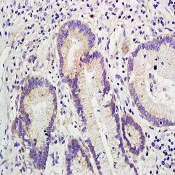 KLK2 Rabbit Polyclonal Antibody