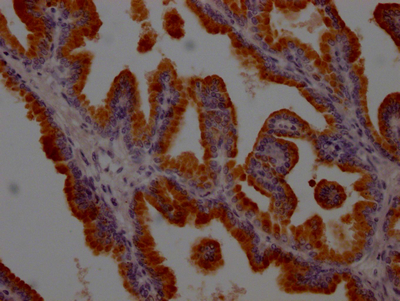 KLK3 Antibody