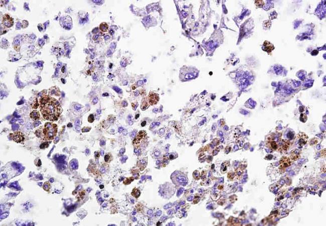 KLK4 Rabbit Polyclonal Antibody
