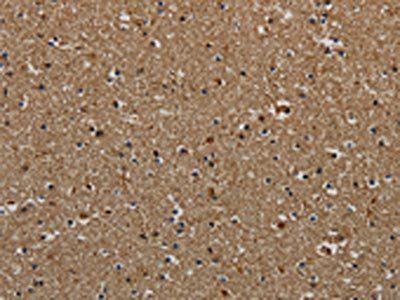 KLK6 Antibody