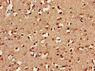KLRD1 Antibody