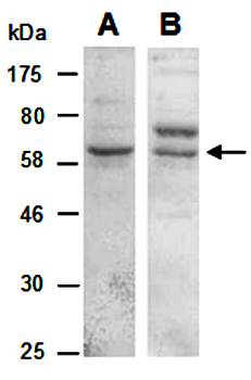 KLRG1 (M) Antibody, Rabbit Polyclonal