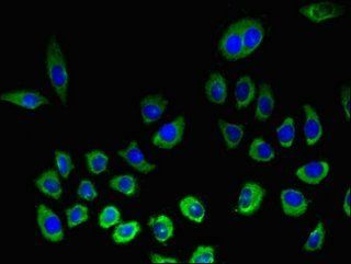 KLRK1 Antibody