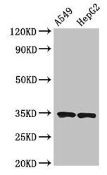 KLRK1 Antibody