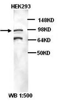 KPNB1 Rabbit Polyclonal Antibody