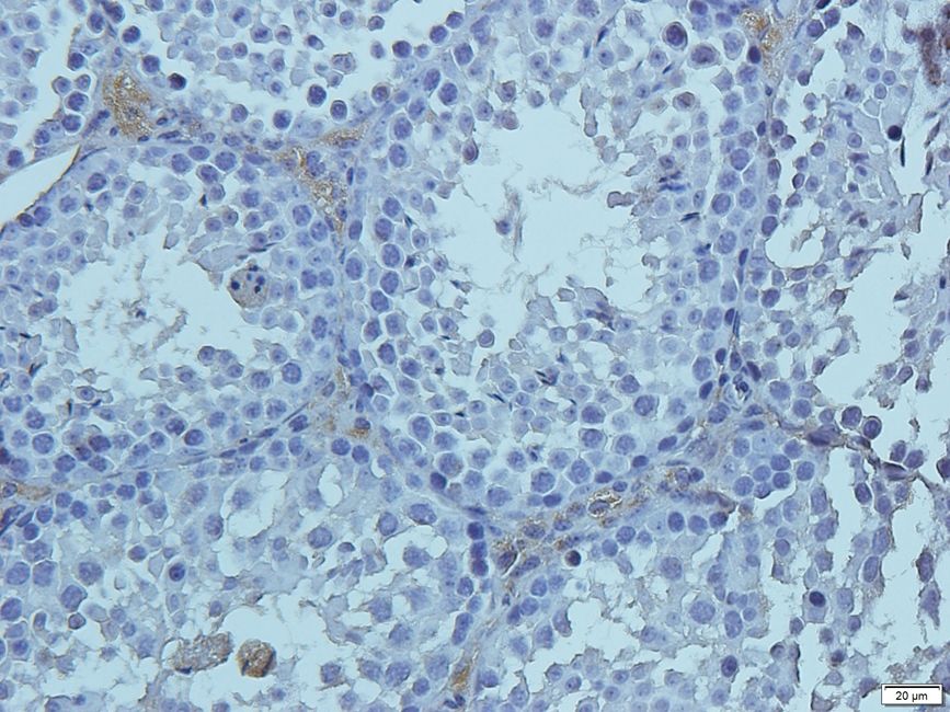 KREM1 Rabbit Polyclonal Antibody