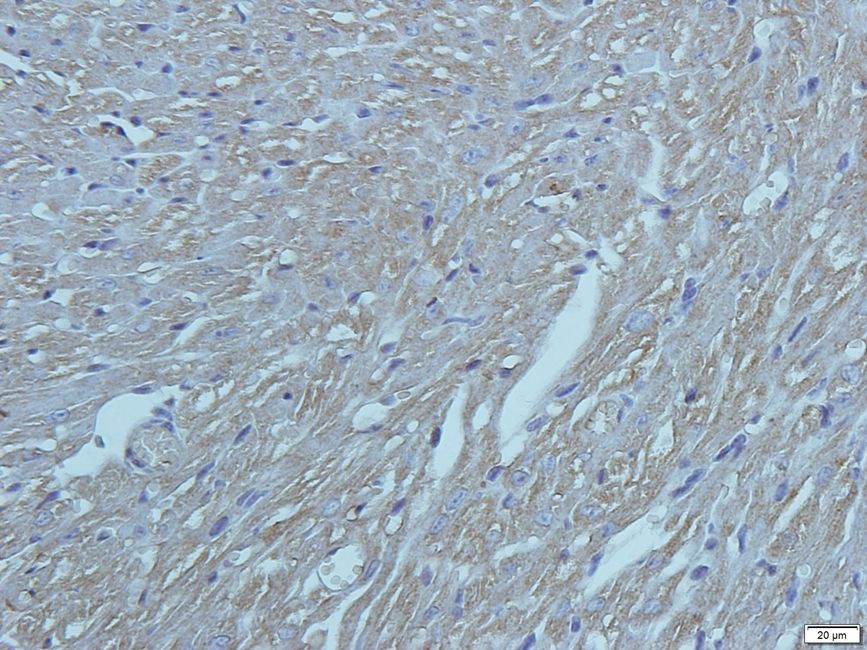KREM1 Rabbit Polyclonal Antibody