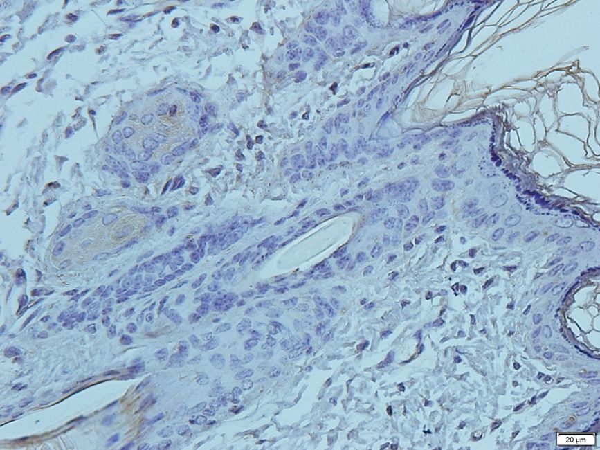 KREM1 Rabbit Polyclonal Antibody