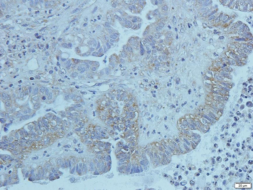 KREM1 Rabbit Polyclonal Antibody